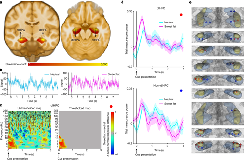 Graphic from Casey Halpern, MD's research paper in Nature titled, 'An orexigenic subnetwork within the human hippocampus.'
